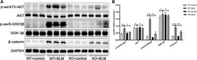 Dec1 Deficiency Ameliorates Pulmonary Fibrosis Through the PI3K/AKT/GSK-3β/β-Catenin Integrated Signaling Pathway